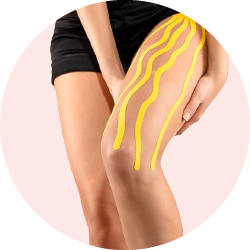 Глюкозамин