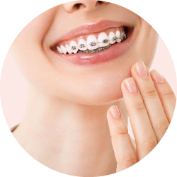 Ортодонтические аксессуары