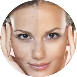 Средства для локального применения